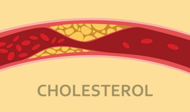 Cholesterol Có Tác Dụng Gì Và Chúng Có Lợi Hay Có Hại?