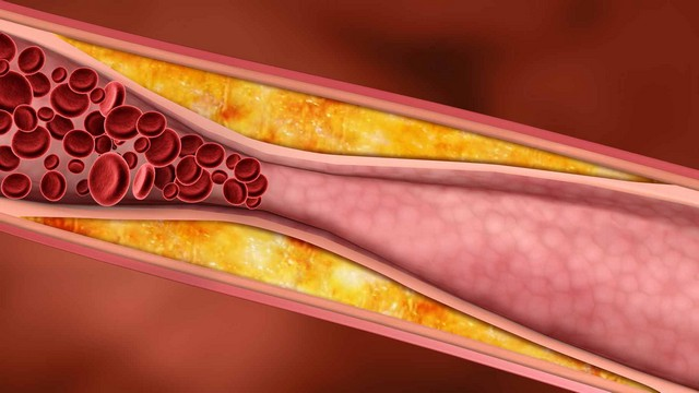 Cholesterol Có Tác Dụng Gì Và Chúng Có Lợi Hay Có Hại?