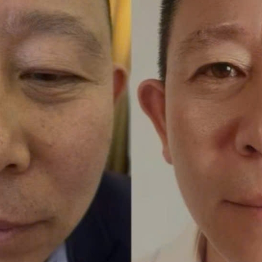 TỔNG HỢP CÁC NHÂN CHỨNG KHI DÙNG GnAKG