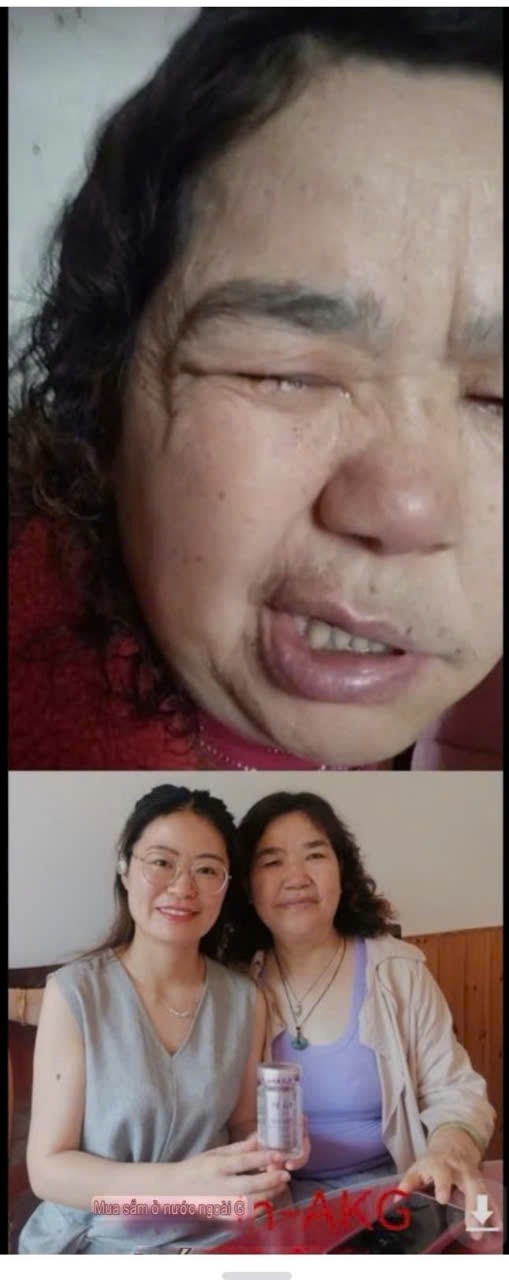 TỔNG HỢP CÁC NHÂN CHỨNG KHI DÙNG GnAKG