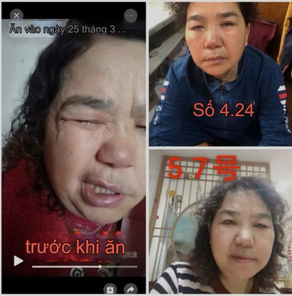 TỔNG HỢP CÁC NHÂN CHỨNG KHI DÙNG GnAKG