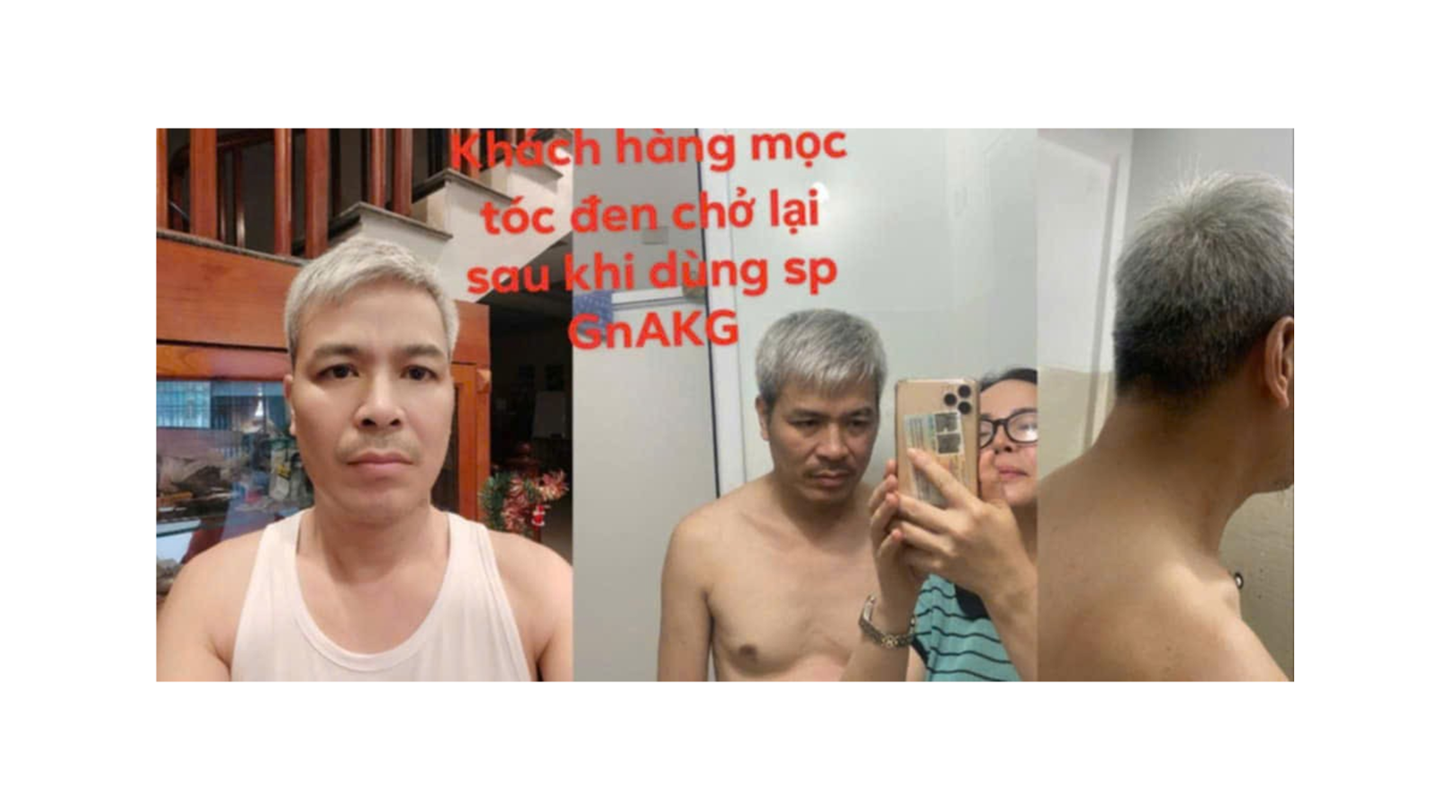 ĐẦU HÓI, TÓC BẠC CẦN BỔ XUNG GÌ