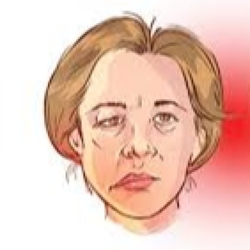 BỆNH NHƯỢC CƠ LÀ GÌ