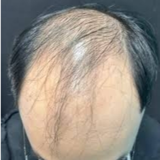 ĐẦU HÓI, TÓC BẠC CẦN BỔ XUNG GÌ