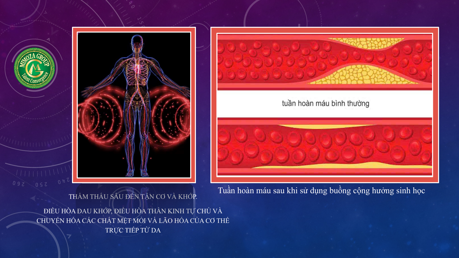 Buồng cộng hưởng từ trường 