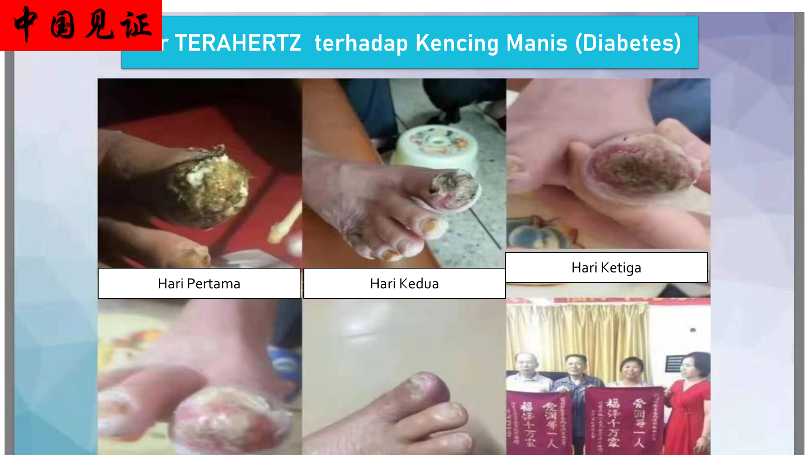 Máy tách nước Siêu phân tử nhỏ 