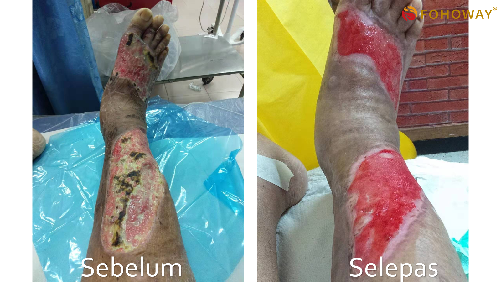 Máy tách nước Siêu phân tử nhỏ 