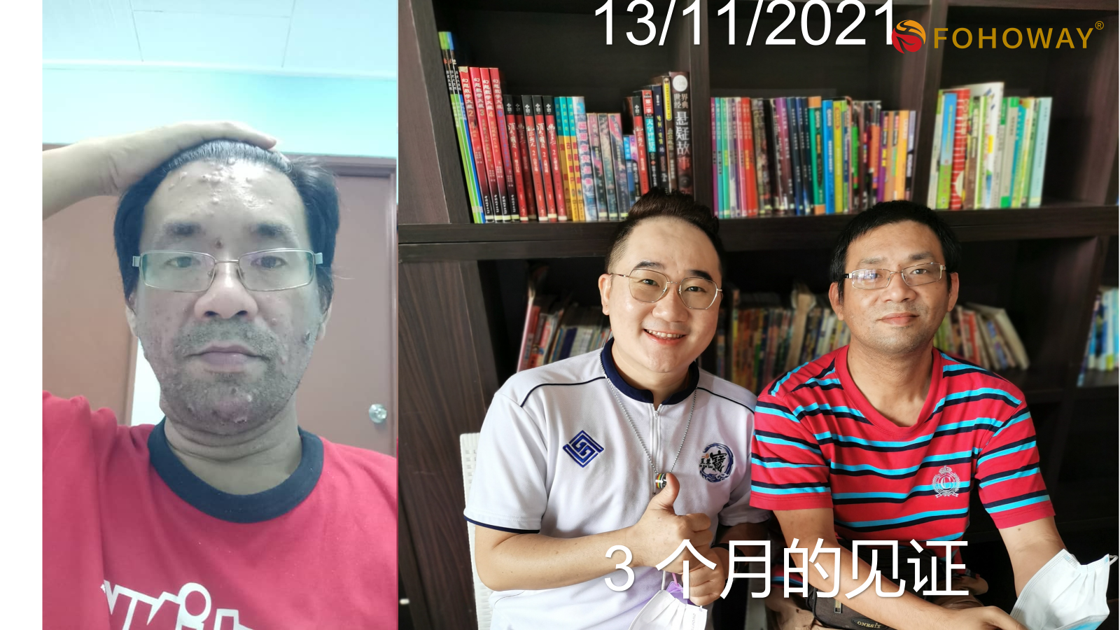 Ca tách nước Siêu phân tử nhỏ 