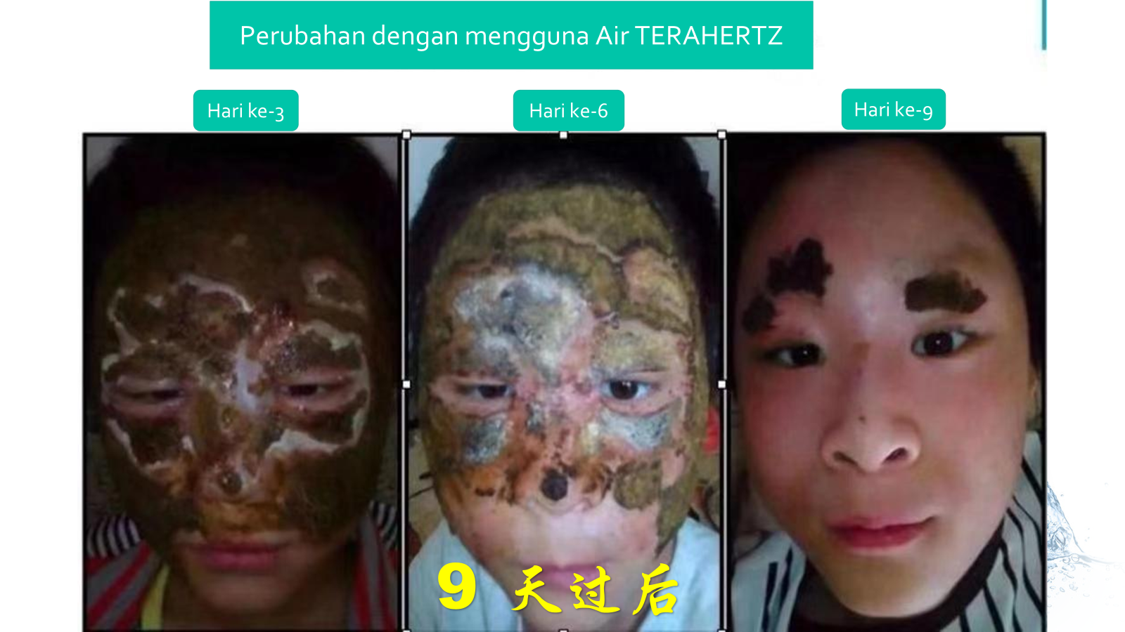 Ca tách nước Siêu phân tử nhỏ 
