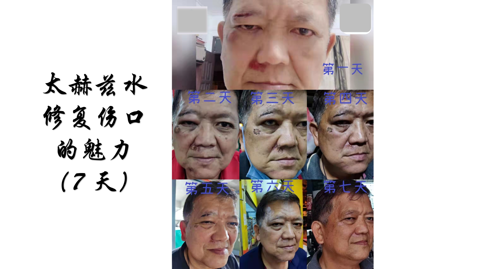 Ca tách nước Siêu phân tử nhỏ 