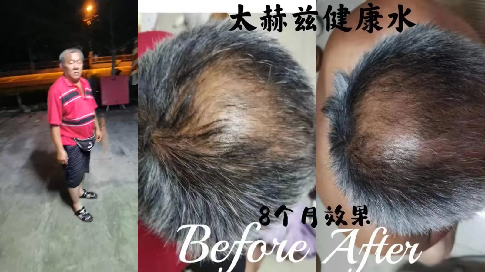 Ca tách nước Siêu phân tử nhỏ 